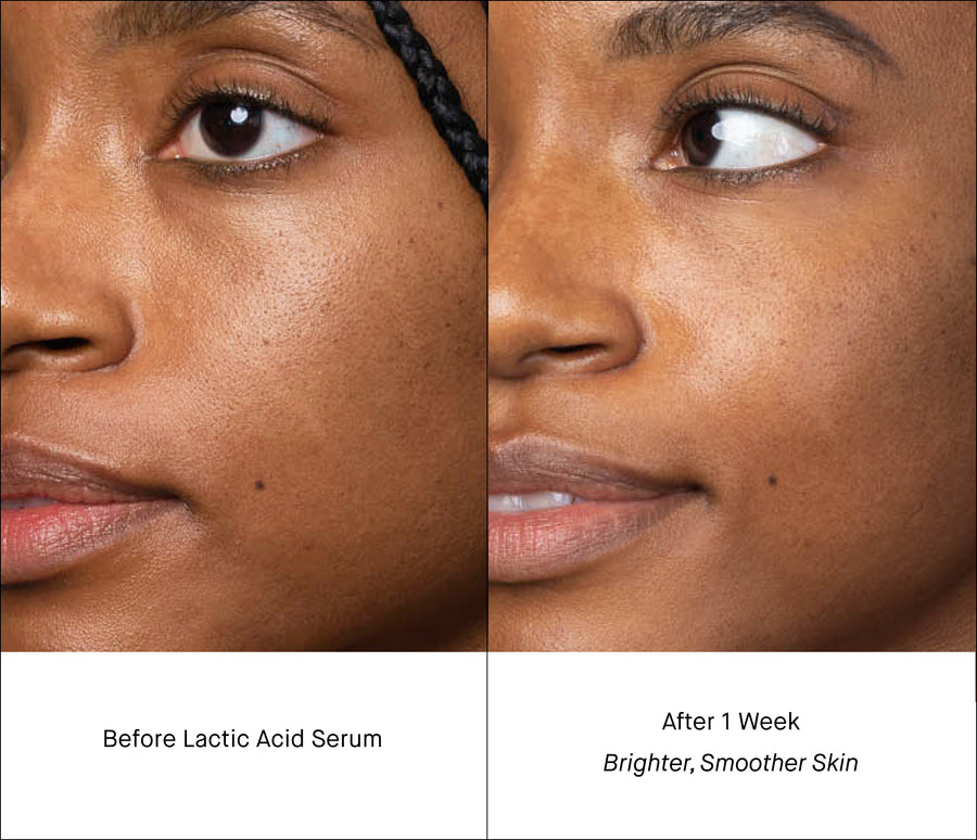 Lactic Acid Serum B&A - Brightness & Tone