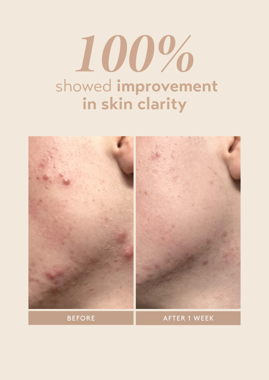 rescue serum